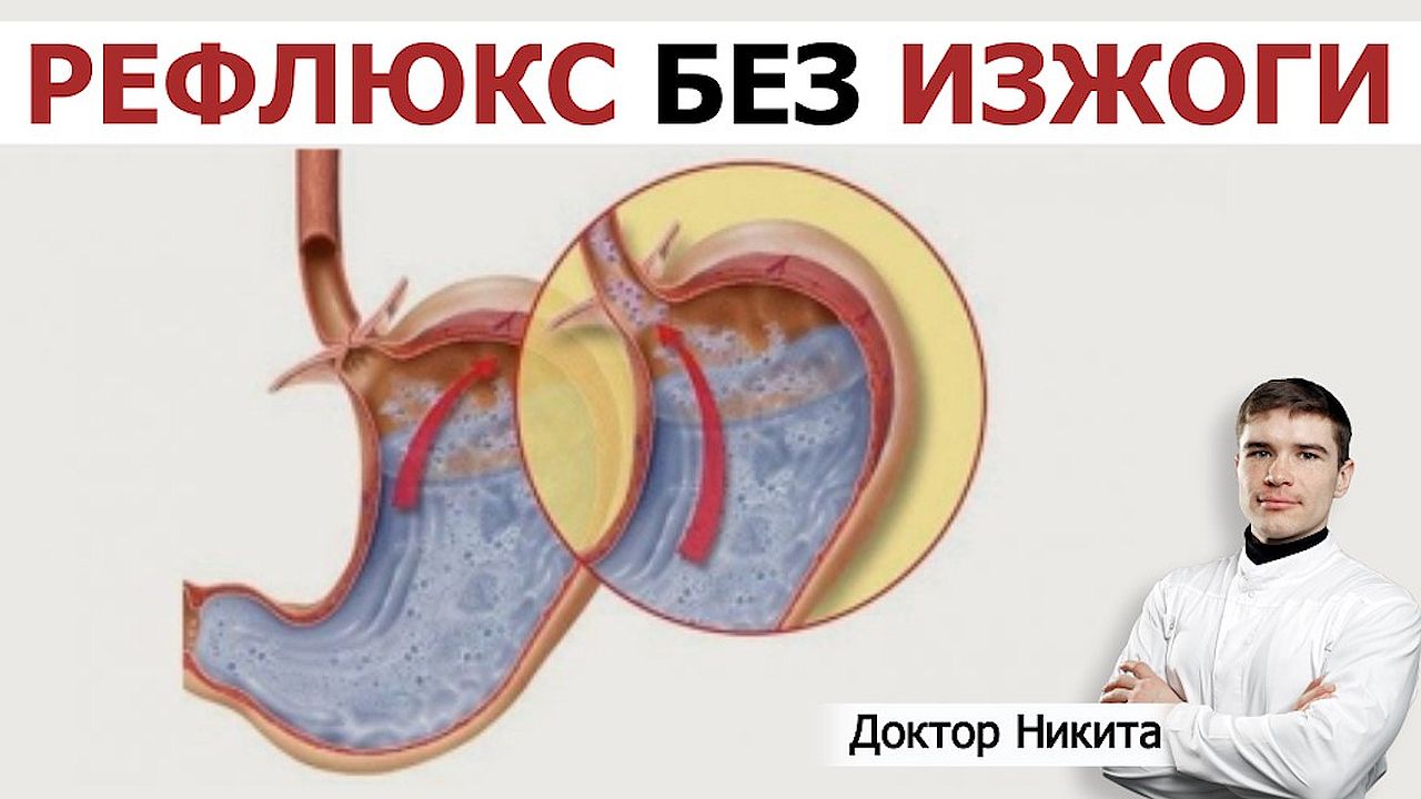 Заброс кислоты из желудка в пищевод без выраженной изжоги. Физиологический рефлюкс или ГЭРБ?