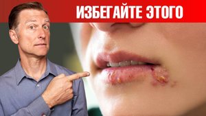 Избегайте этих продуктов, если у вас герпес! 👀