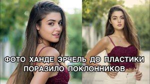 ФОТО ХАНДЕ ЭРЧЕЛЬ ДО ПЛАСТИКИ ПОРАЗИЛО ПОКЛОННИКОВ. Ханде Эрчел. Hande Erçel. Турецкие актёры .