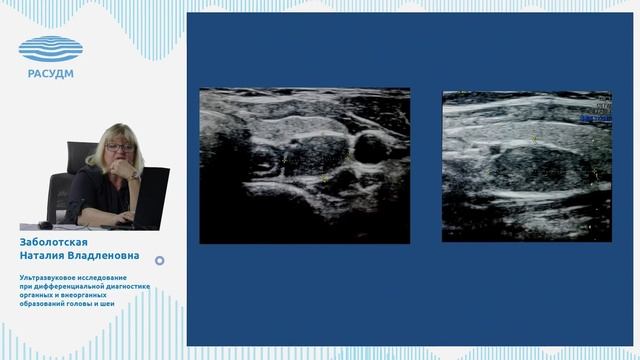 Ультразвуковая диагностика органных и внеорганных образований головы и шеи