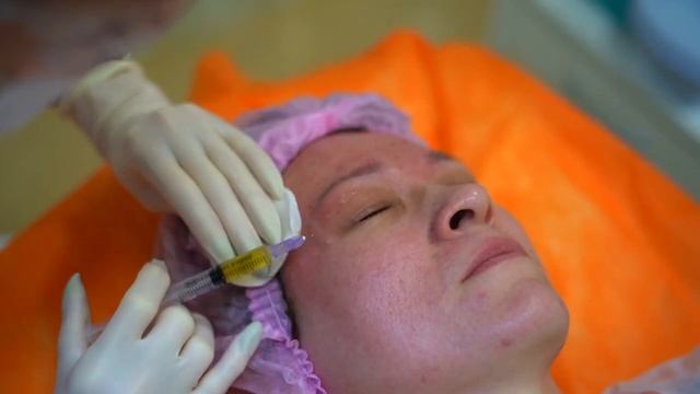 Плазмолифтинг по Швейцарской методике смотреть онлайн