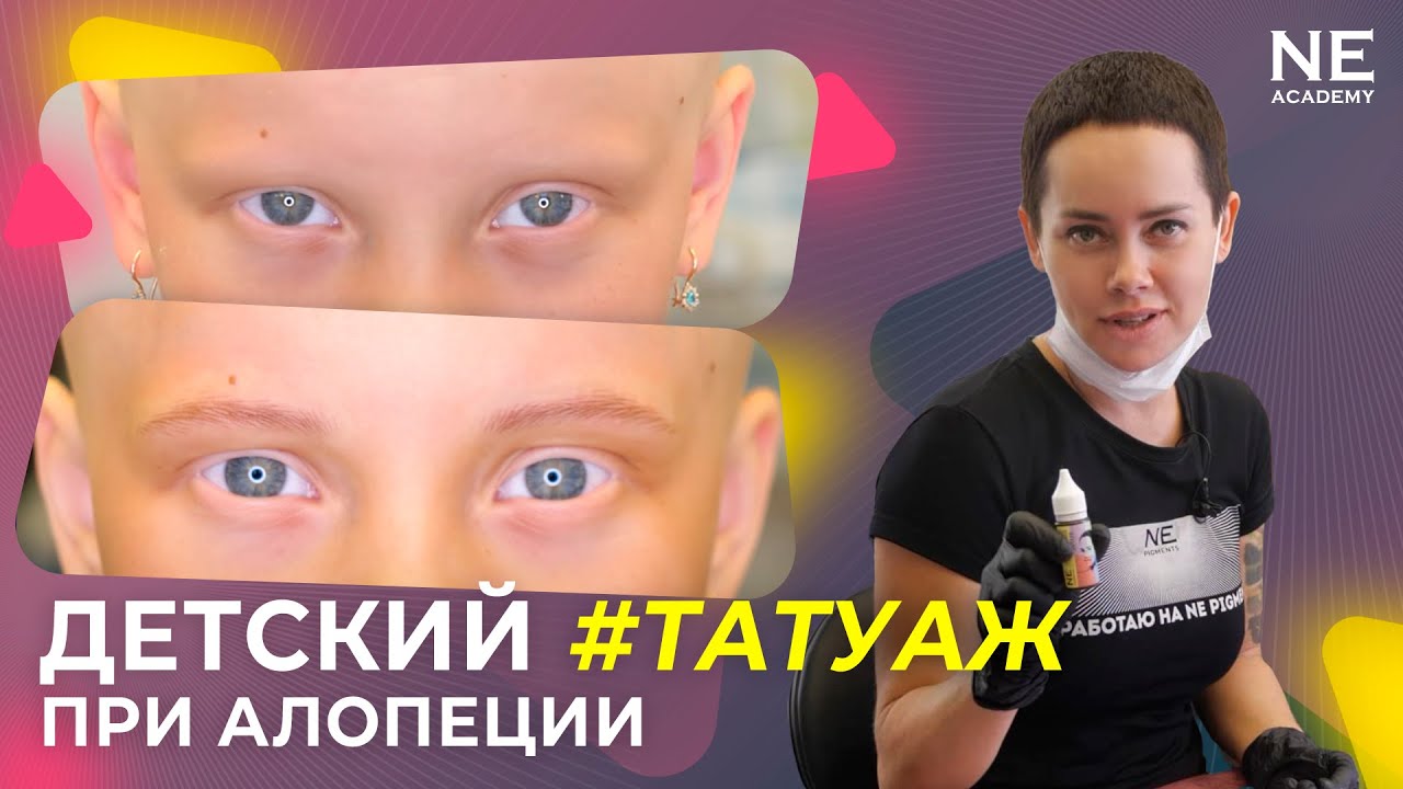 Детский татуаж при алопеции