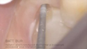 Вертипреп  / Vertiprep