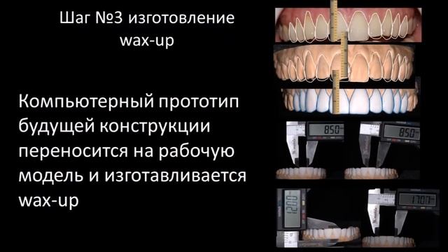 Курс по цифровому моделированию улыбки DSD 24-25 марта 2018