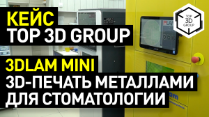3DLAM Mini: 3D-печать металлами для стоматологии - кейс Top 3D Group