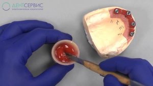 Трансфер–чек: быстро и просто