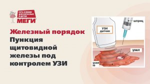 Когда делать пункцию щитовидки?