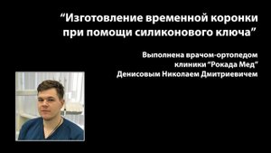 "Изготовление временной коронки при помощи силиконового ключа"
