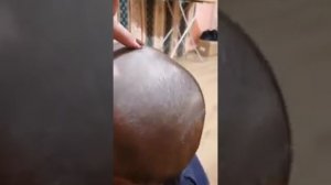 Наша история лечения алопецию у ребенка