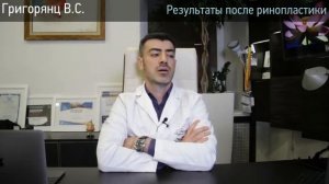 Когда оценивать результат после ринопластики