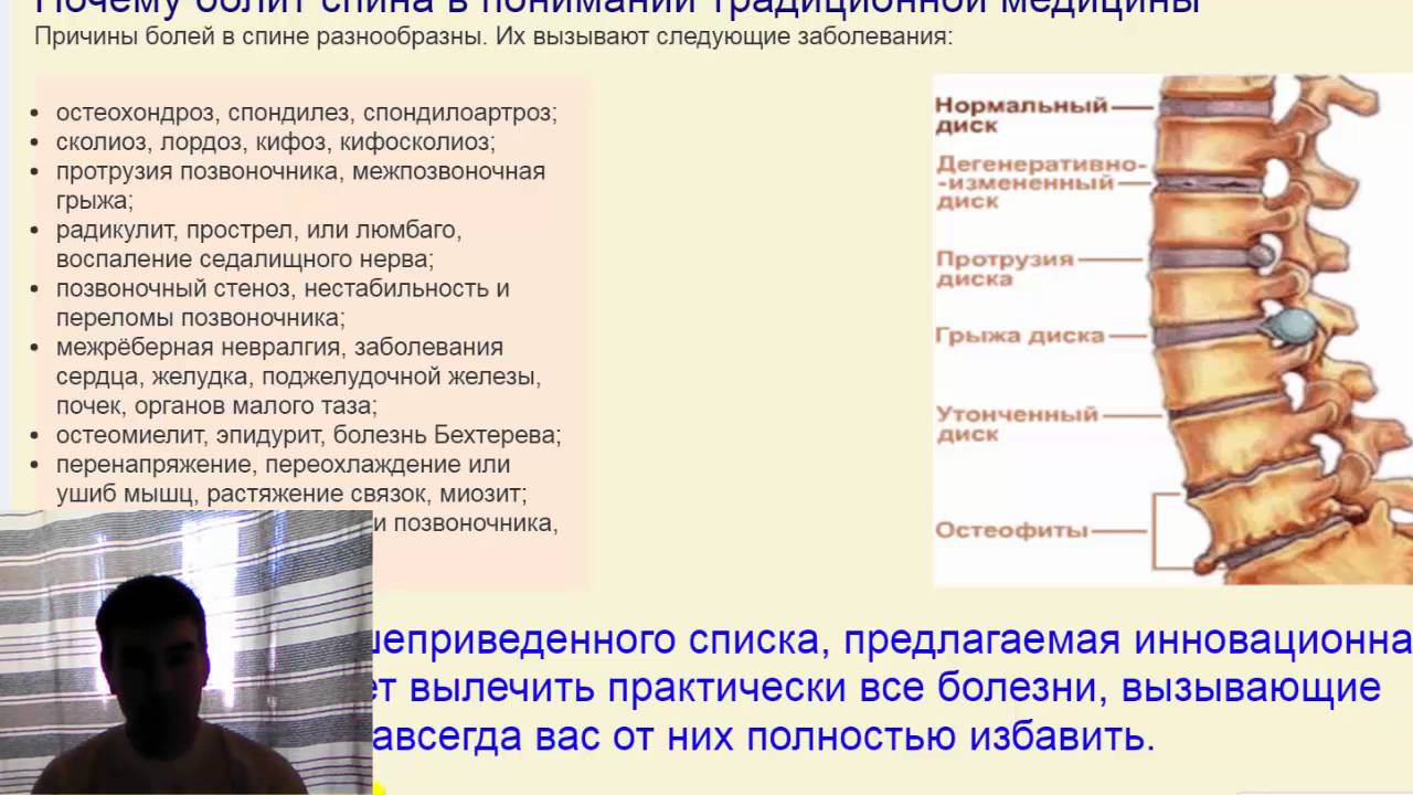 Мифы и реальность: Лечение позвоночника. Боль в спине. ч1