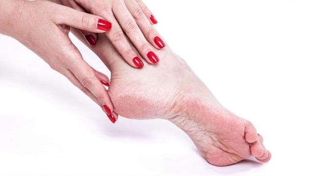 Растворила всего 20 гр. борной кислоты, вот что стало с ногами... Как избавиться от трещин на пятка смотреть онлайн