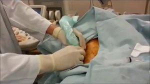 Биопсия почки