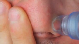 Pore cleaner вакуумный очиститель кожи