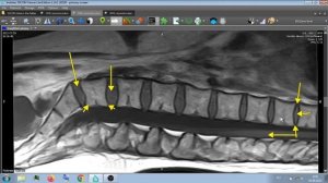 МРТ ПОЯСНИЧНЫЙ ОТДЕЛ.