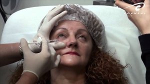 Избавляемся от темных кругов под глазами