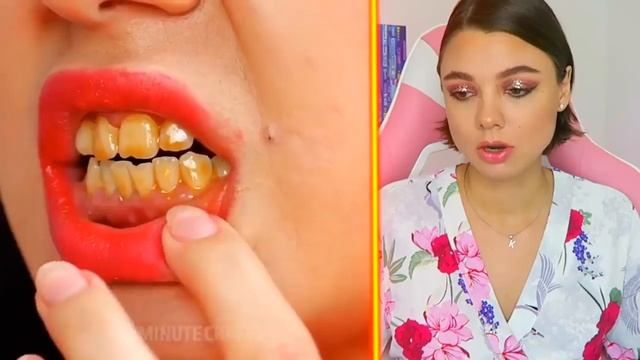 Лайфхаки Красоты Которые РаботаютКак Отбелить Зубы Дома