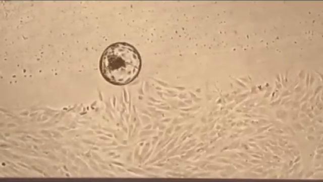 Имплантация. Внутренний космос смотреть онлайн