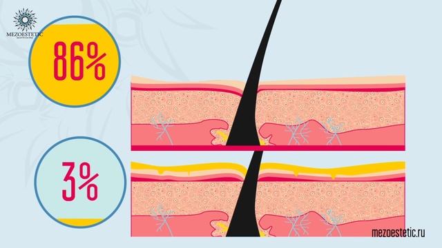 Dermapen Дермапен - Аппарат фракционной микроигольчатой мезотерапии