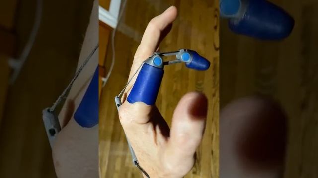 The Danger Finger 5 Beta - DIY Prosthetic