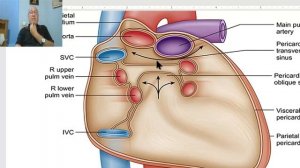 Anatomy CVS  Module  in Arabic  11  ( Transverse sinus of pericardium) ,  by Dr, Wahdan