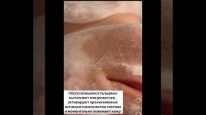 WOW - процедура