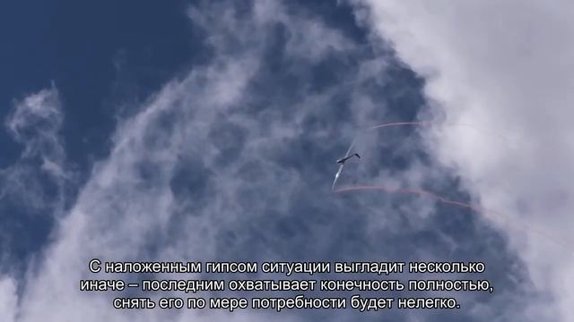 Почему могут не пустить в самолёт с гипсом смотреть онлайн