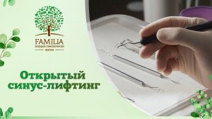 ? Открытый синус-лифтинг