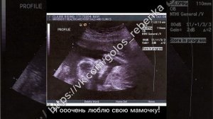 Послание малыша папе на гендер пати..