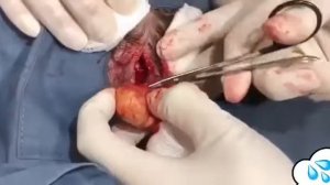 ЖИРОВИКИ № 1