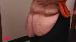 Большие успехи - Я вешу 300 кг: что было дальше?