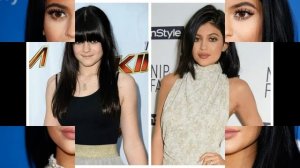 КАКОЙ БЫЛА КАЙЛИ ДЖЕННЕР ДО ПЛАСТИКИ! Вы удивитесь!