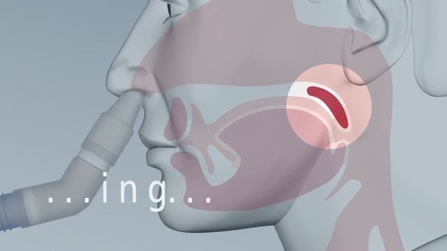 PARI SINUS | Hoe gebruikt u de PARI SINUS juist смотреть онлайн