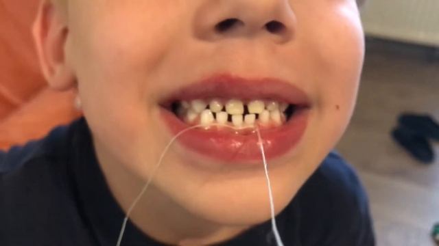 Вырвать зуб МАШИНКОЙ смотреть онлайн