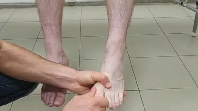 Как избавиться от косточки на ноге в домашних условиях? Избавление от косточки на ноге. смотреть онлайн