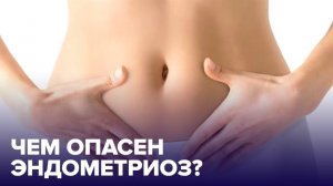 Что такое ЭНДОМЕТРИОЗ и как от него избавиться?