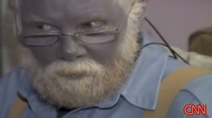 Человек с голубой кожей