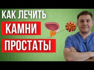 Как лечить камни ПРЕДСТАТЕЛЬНОЙ ЖЕЛЕЗЫ .