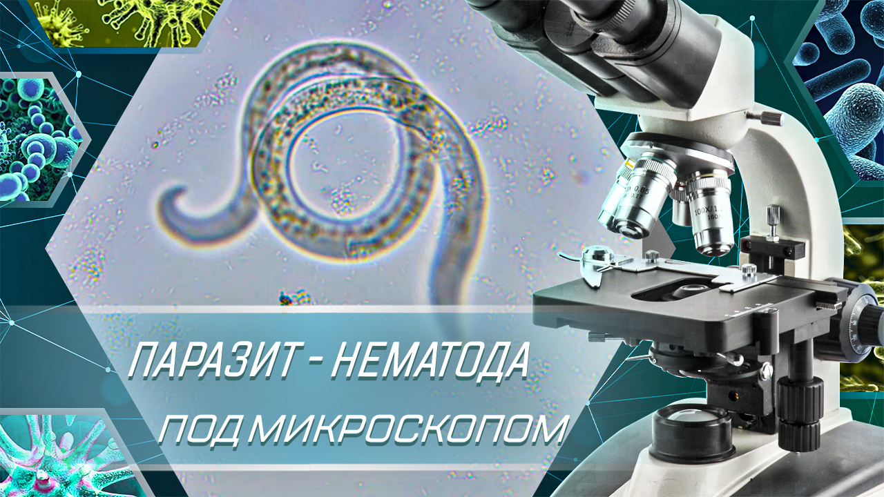 Нематоды под микроскопом
