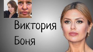 Виктория Боня. ЭСКОРТ. Психологический портрет. УПОТРЕБЛЕНИЕ АУЯСКИ. Пластические операции.