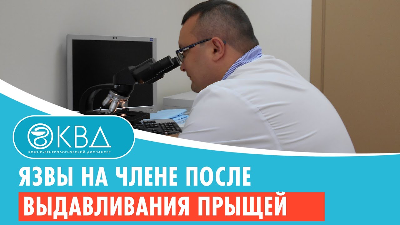 Язвы на члене после выдавливания прыщей. Клинический случай №154