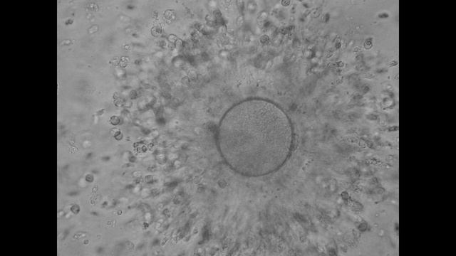 Самое важное про ЭКО. Мифы и факты. О здоровье и не только с доктором Фараджовым. смотреть онлайн