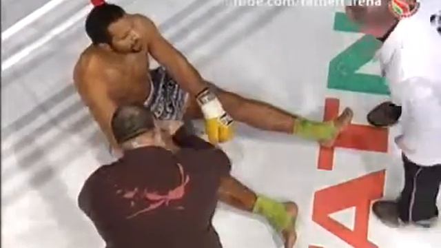 сломал ногу смотреть онлайн