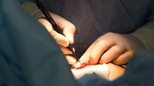 Какие опасные опухоли могут появиться в молочной железе?