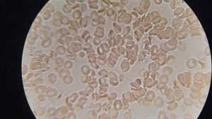 КЛЮКВА влияет на кровь человека