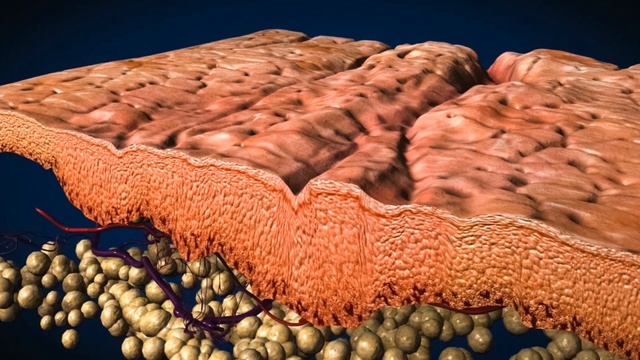 С помощью ЭТОЙ ПРОЦЕДУРЫ вы ИЗБАВИТЕСЬ от послеродовых растяжек НАВСЕГДА смотреть онлайн