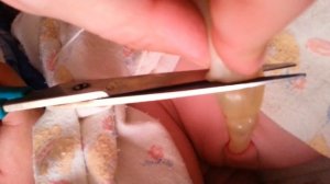 Как перерезать пуповину новорожденному