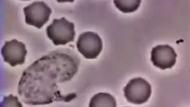 Сцена охоты нейтрофила за бактерией