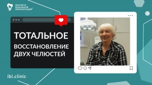 ОТЗЫВ ПАЦИЕНТА: Имплантация зубов без осложнений и боли.