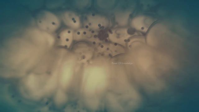 The Mechanism Of Pneumonia - 3D Animation (Urdu/Hindi) смотреть онлайн